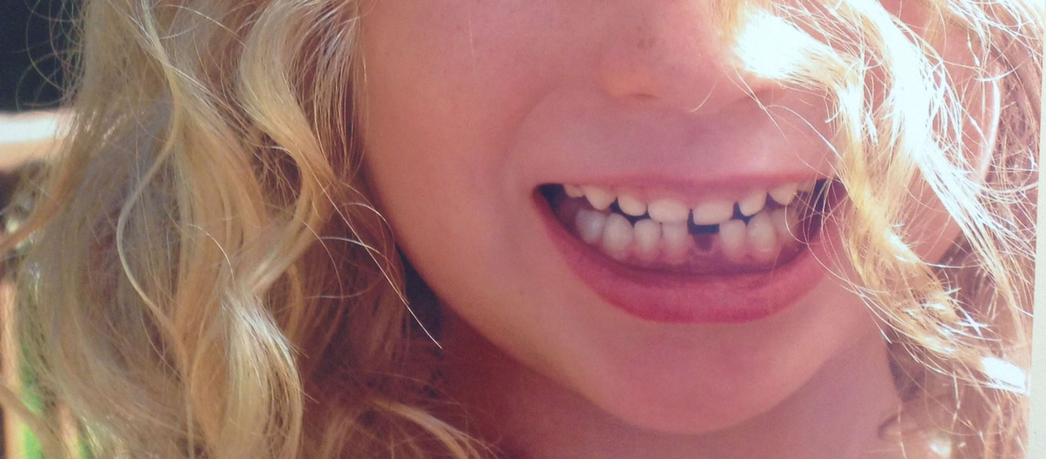 Dr. Derek Widmayer, aka Derek the Dentist, and his team is a full service dental practice offering family, cosmetic and implant dentistry in West Orange, New Jersey