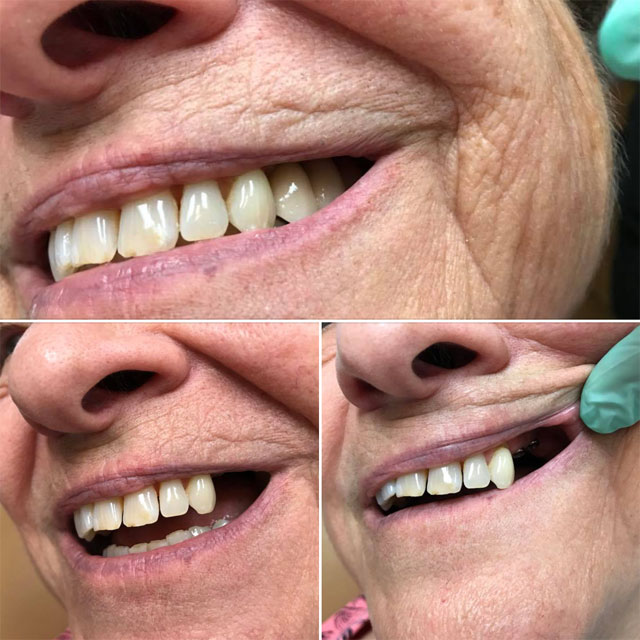 Derek Widmayer, Derek the Dentist, Denville NJ dentist